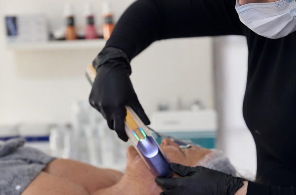 HIFU para rejuvenescimento: vale a pena? Resultados, riscos e para quem é indicado